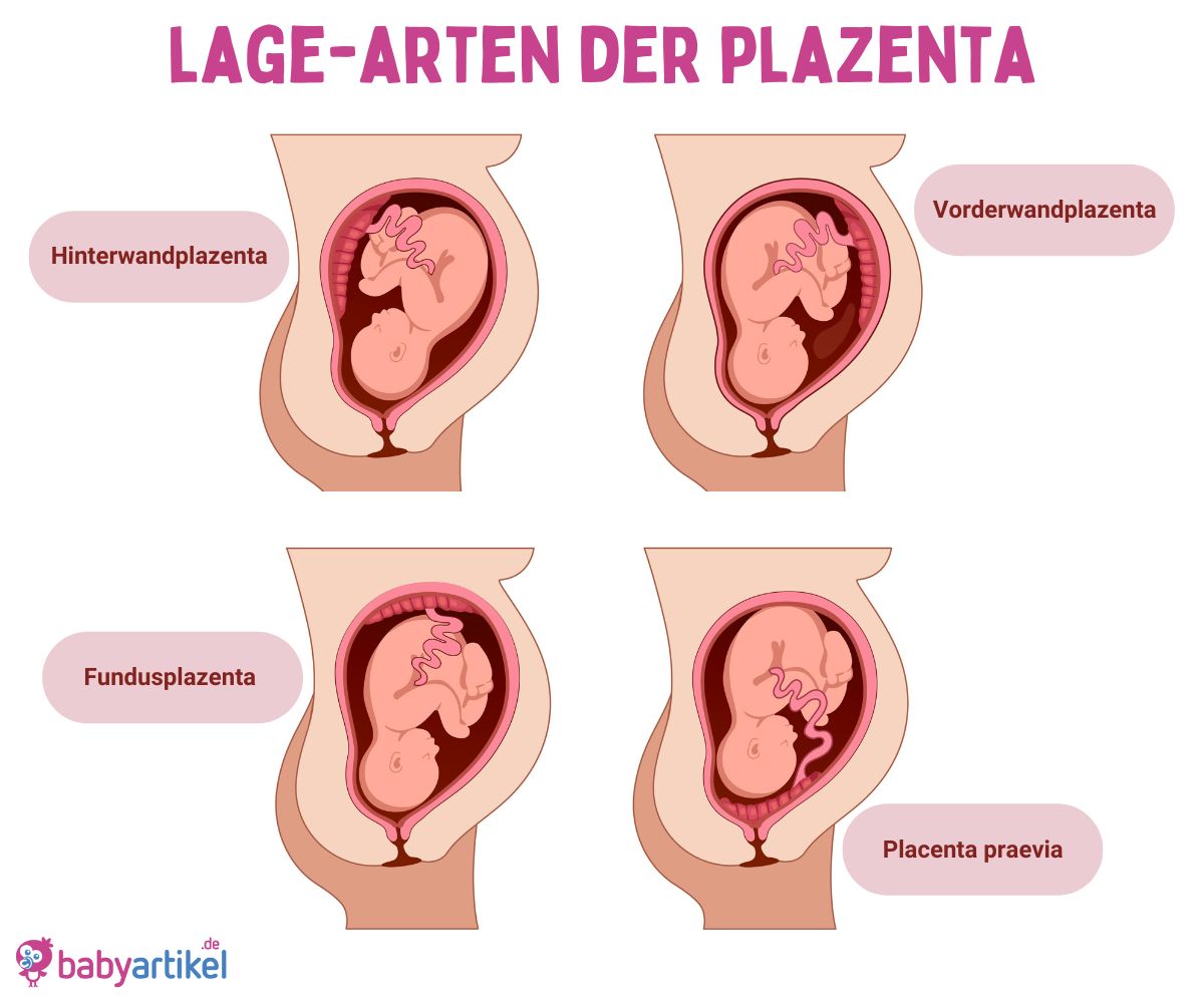 Wie Teuer Ist Eine Plazenta www.babyartikel.de