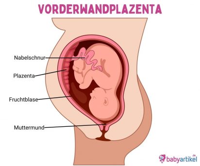 Vorderwandplazenta: Häufigkeit, Diagnose, Risiken | Babyartikel.de